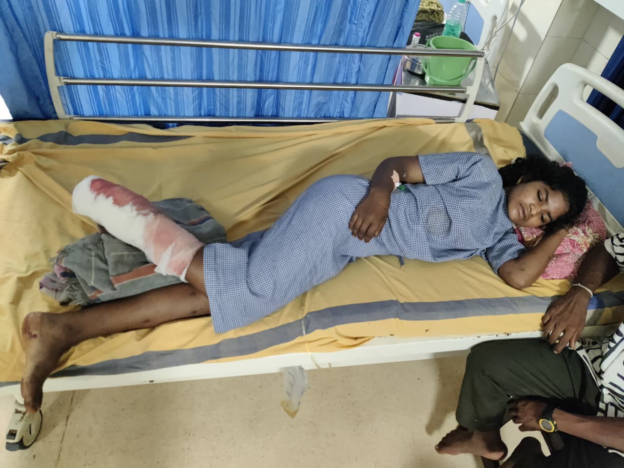 Naxalite Injured In IED Blast