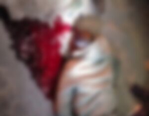 Chhattisgarh Road Accident